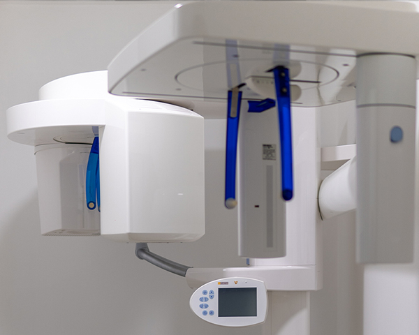 Tomografia Computerizza Cone Beam (CBCT) Bari